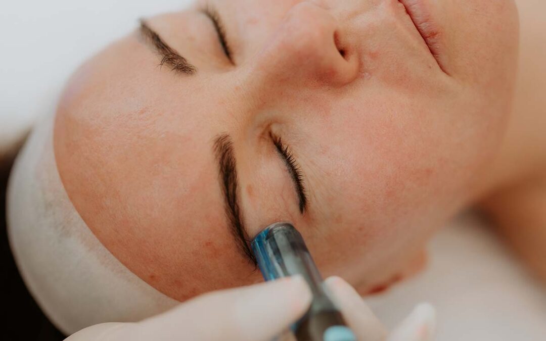 The Advantages of Eyelid Surgery and Who Should Consider It