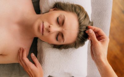 Explore the Advantages of Microneedling in Revitalising the Skin