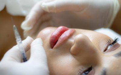 Achieve A Natural Look with Dermal Fillers: Secrets and Aftercare Tips