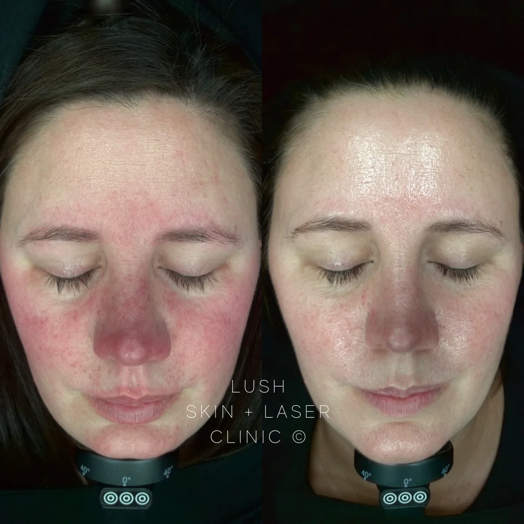 lush before and after 2024.1