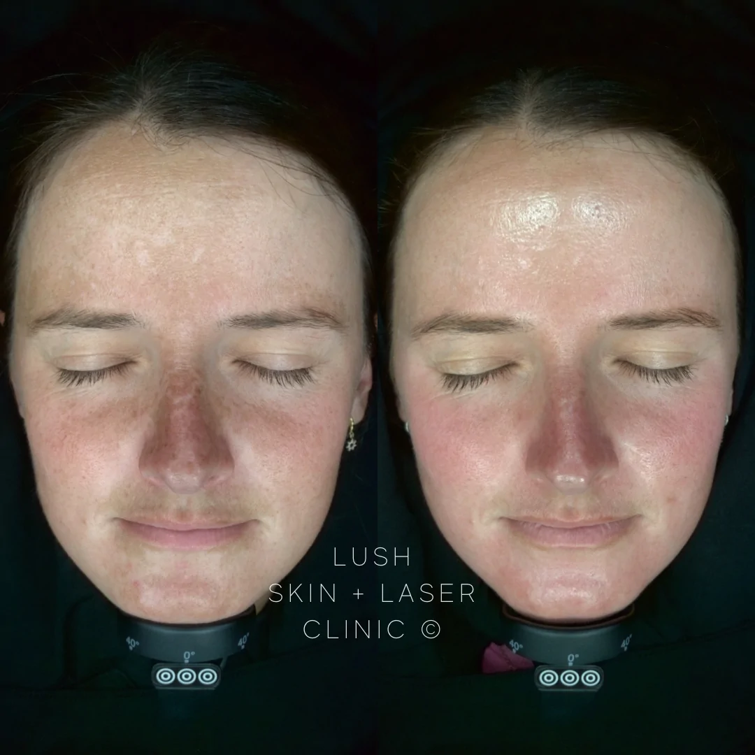 lush before and after 2024