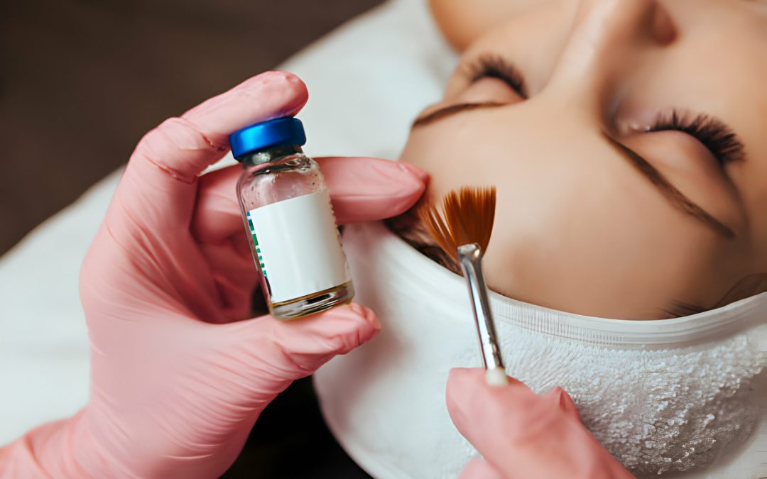 What Are The Benefits Of Chemical Peels In Revitalising Your Complexion