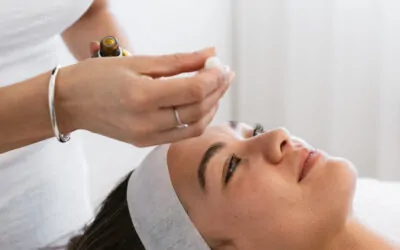 Preventing and Treating Acne Scars: Strategies for Clearer Skin