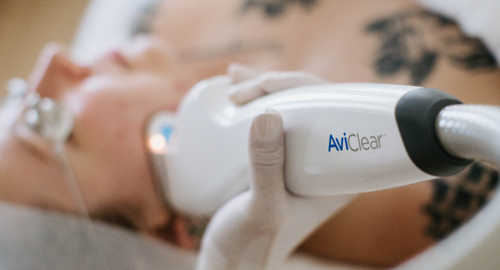 lush aviclear acne treatment device in shepparton