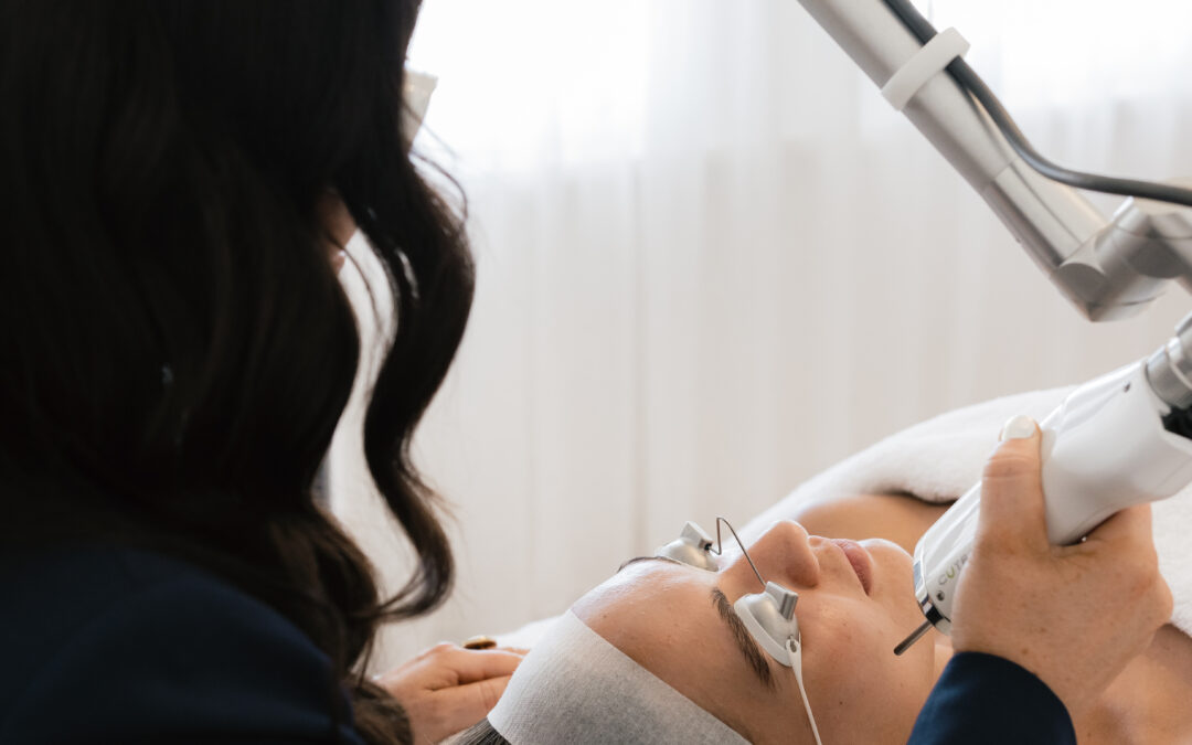 How AviClear Laser Treatment Helps Peri/menopausal Women Combat Hormonal Acne