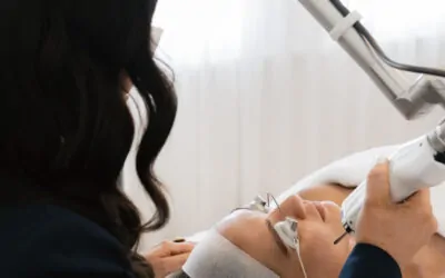 How AviClear Laser Treatment Helps Peri/menopausal Women Combat Hormonal Acne